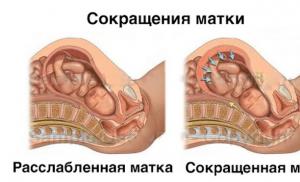 Dijagnostika i liječenje tonusa maternice tijekom trudnoće