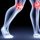 Deformirajući osteoartritis (osteoartritis) - opis bolesti i metode liječenja