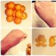 Alergija na narandže i mandarine - foto manifestacije Kako se alergija na mandarine manifestira kod odraslih